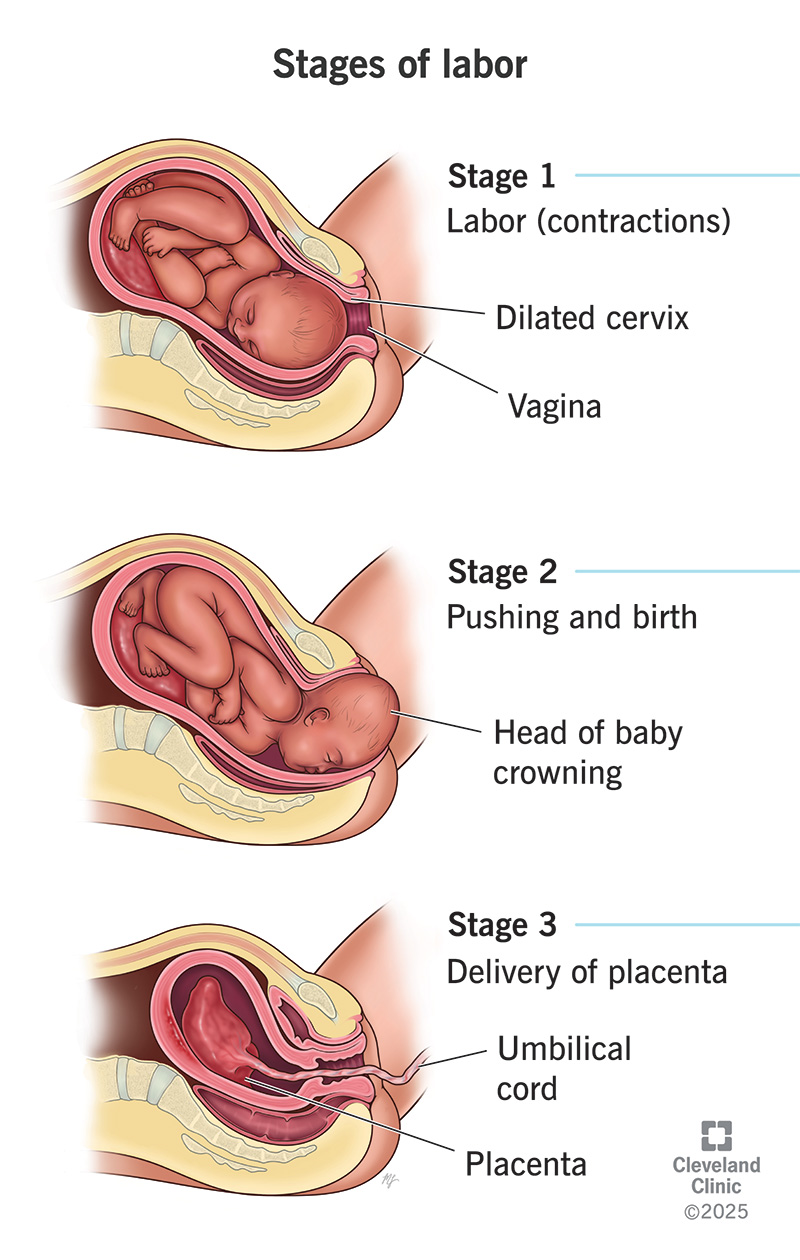 Normal Labour Definition Stages Physiology Management and Clinical Features